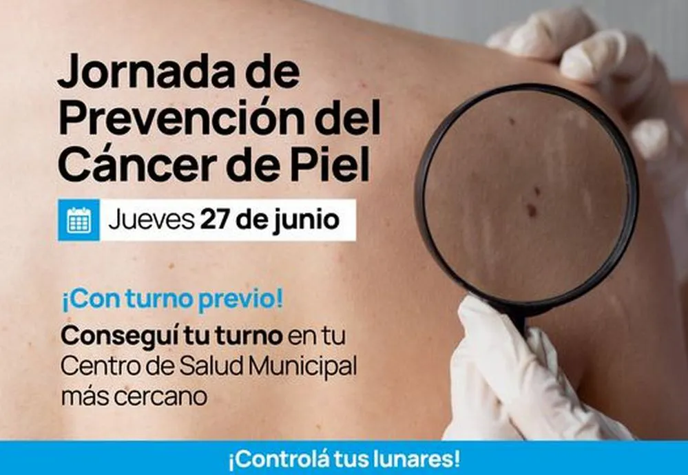 REGION OBJETIVO FOTO ALTA GRACIA PREVENCION CANCER PIEL