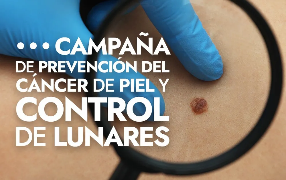 REGION OBJETIVO FOTO VILLA CARLOS PAZ CAMPAÑA LUNARES 2025 1